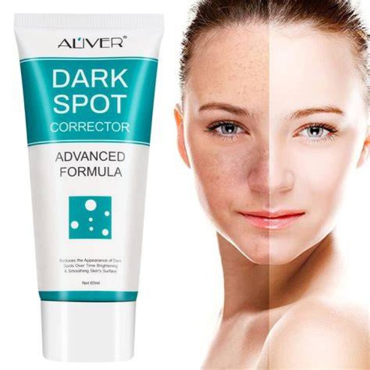 Best Dark Spot Removal Cream: Your Ultimate Guide To Radiant Skin