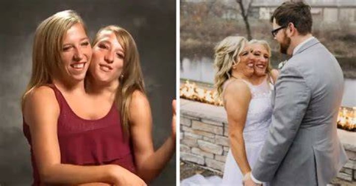Conjoined twin Abby Hensel confirms marriage to army veteran Josh