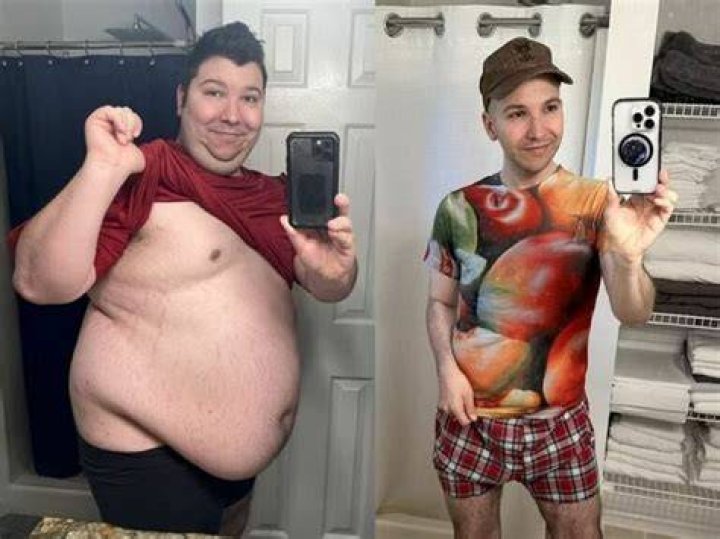 Nikocado Avocado Weight Loss Journey Before And After Photos