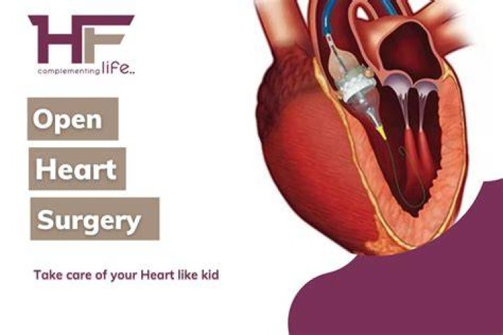 Open Heart